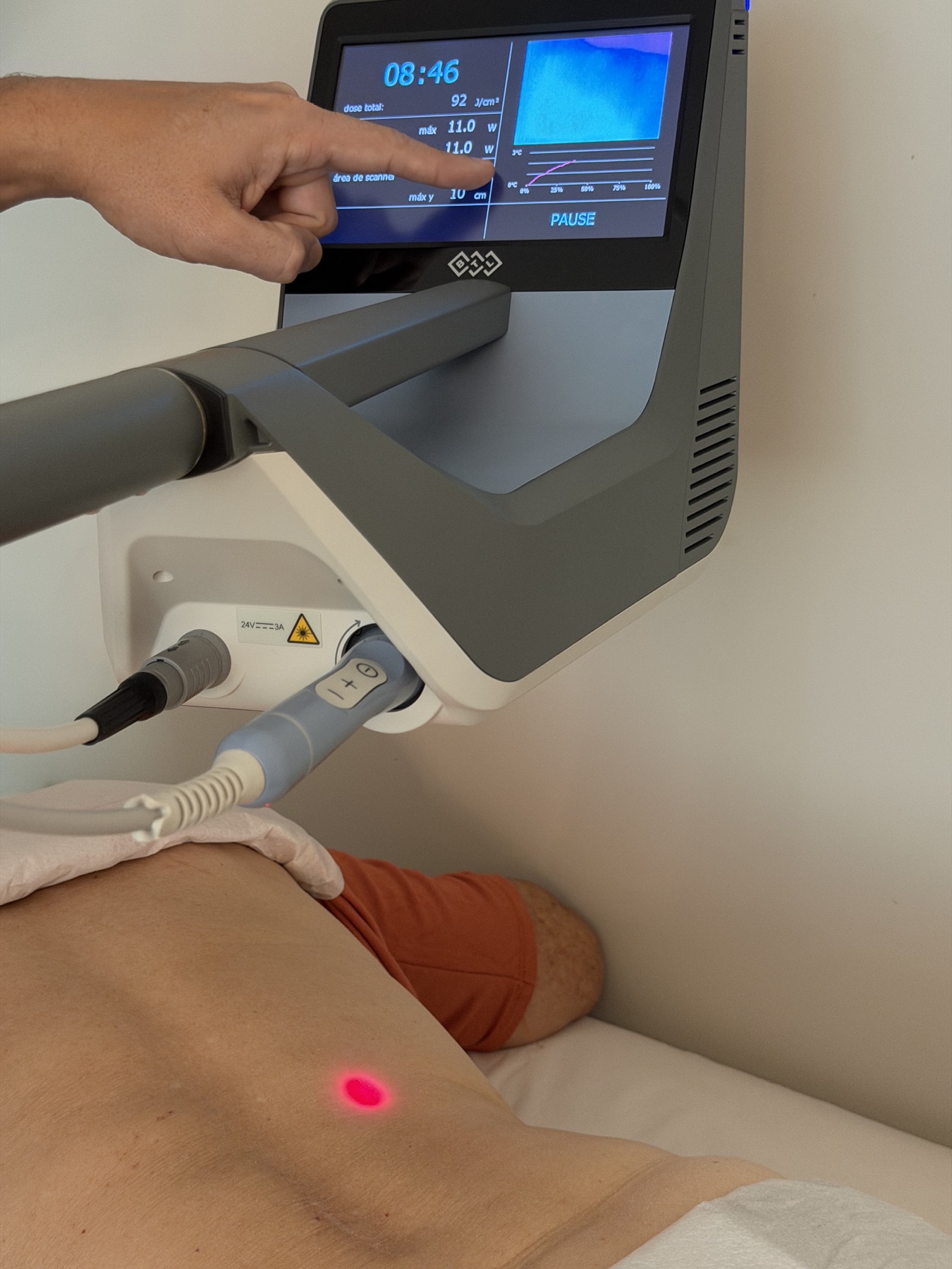 Aplicação de laserterapia durante um atendimento